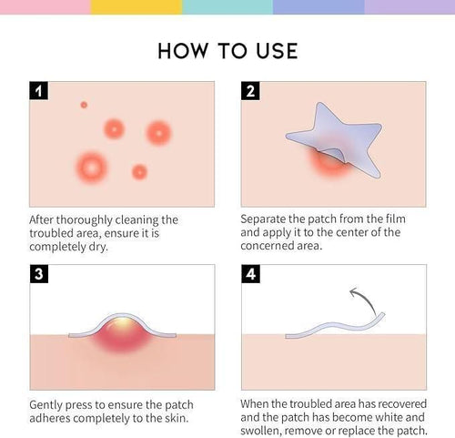 30 Pcs Pimple Patches